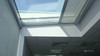Store Veranda Coffre Aluminium Anthracite RAL 7016 Detail
